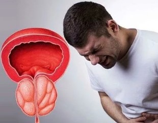 Simptomi hroniska prostatīta vīriešiem